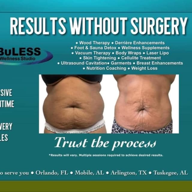 Flabuless 4D 360 SlimDown Treatment at Flabuless Wellness Studio- Arlington in Arlington, TX